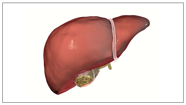 GALLBLADDER-STONES:--CAUSES,-RISKS,-DIET,-AND-MORE