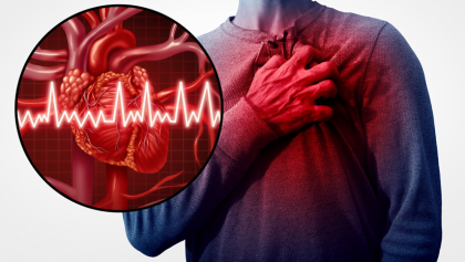 What Are The Causes Of Heart Attack? Is High BP One Of Them?